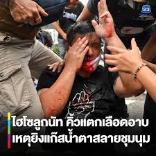ลั่นตาบอดจริงไม่บอดทิพย์ ให้หมอ 300 คนมาตรวจก็ได้ เผยได้พูดคุยกับ สิระ เป็นคนสุภาพเรียบร้อย ไม่รู้ใครไปป้ายสี. à¹„à¸®à¹‚à¸‹à¸¥ à¸à¸™ à¸— à¸– à¸à¹à¸ à¸ªà¸™ à¸³à¸•à¸²à¹€à¸‚ à¸²à¸•à¸²à¸‚à¸§à¸² à¸‚ à¸²à¸§à¹€à¸§ à¸£ à¸„à¸žà¸­à¸¢à¸— 23 Facebook