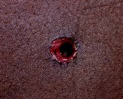 Velocity is classified as low (<1000 fps), medium (1000 to 2000 fps), and high (>2000 fps). Gunshot Wound Deaths Springerlink