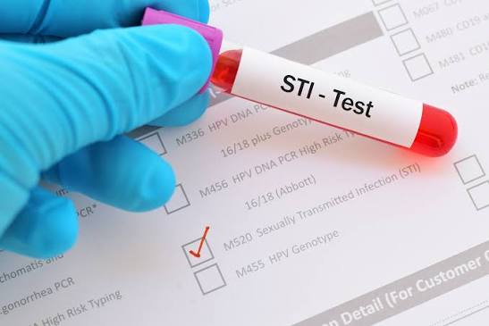 Confidential STI screening and sexual health consultation in Pomona California