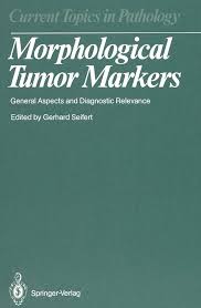 Morphological Tumor Markers: General Aspects and Diagnostic Relevance  (Current Topics in Pathology): Gerhard Seifert, M. Altmannsberger:  9783540167334: Amazon.com: Books