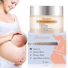Our skin is living and active, so it's constantly responding. The Best Stretch Mark Product June 2021