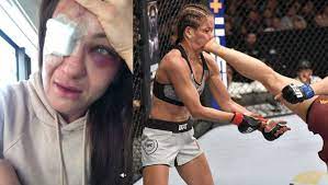 Gamrot trafił palcem w oko irlandczyka, zaś decyzją sędziego marca goddarda walka została uznana za. Mma Dramat Karoliny Kowalkiewicz Czeka Ja Operacja Oka Wideo Sport Tvp Pl