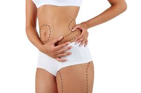 Guidelines For Reducing Bleeding After Plastic Surgery Liposuction Mommy Makeover Surgery Mommy Makeover