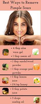 Pin On Acne Scars Pitted