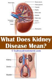 Kidney Disease Symptoms Other Kidney Disease Diet Kidney Disease Symptoms Kidney Disease