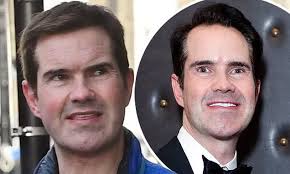 James anthony patrick carr (born 15 september 1972) is an english comedian, writer and television presenter. Jimmy Carr Has Had His Teeth Fixed And A Hair Transplant Daily Mail Online