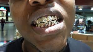 10k yellow 10k white 10k rose 14k yellow 14k white 14k rose 18k yellow 18k white 18k rose 22k yellow 22k white 22k rose. 14k Solid White Gold Custom Fit Real Gold Grill Grillz Gold Teeth
