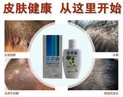 The value array of american crew's hair care products also have sun protection to the nerves in your hair loss is more than the component minoxidil. Coal Tar Hair Lotion Excessive Fat Dermatitis Dandruff Tinea Capitis Psoriasis Hair Loss Shampoo Potion Psoriasis Head Ointment Hair Loss Ointment Aliexpress