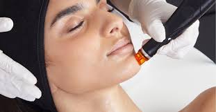 A Comprehensive Guide to Hydrafacial: The Ultimate Skincare Treatment -  DESSNA