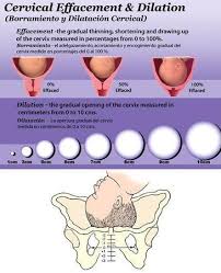 Share Your Current Stats Week Dilation Effacement