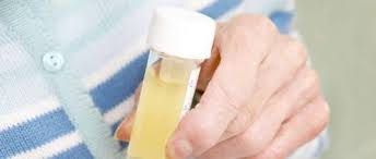 We did not find results for: Si Votre Urine Est Malodorante Voila Ce Que Ca Pourrait Etre