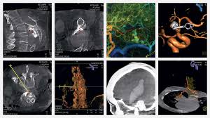 Image intensifiers (often abbreviated as i. What Is The Difference Between An Image Intensifier And A Flat Panel Detector Med Equipment Blog Medical Equipment For Hospitals