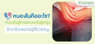 โรคหนองใน คืออะไร? หนองในผู้ชายและหนองในผู้หญิง - intouchmedicare