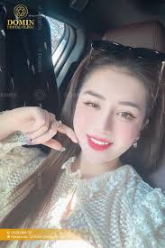 Dáng răng khểnh (Enhanced) là gì? Có nên giữ lại răng khểnh?