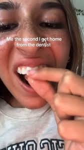 If you get fluoride varnish