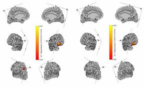 Please click this link to register. Frontiers Exploring The Neural Structures Underlying The Procedural Memory Network As Predictors Of Language Ability In Children And Adolescents With Autism Spectrum Disorder And Attention Deficit Hyperactivity Disorder Human Neuroscience