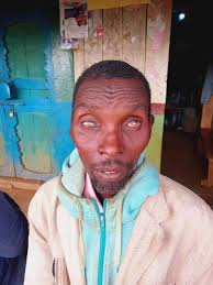 The only man with kabuchai chwele ward vision in his hand . Eric wekesa ✓