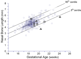 reference ranges of nasal bone length from 15 to 24 weeks