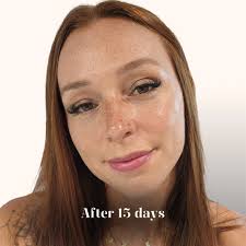 FM Beauty Clinic (@fmbeauty.studio) • Instagram photos and videos