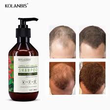 Hair growth shampoo, hair loss shampoo, hair thickening shampoo, helps stop hair loss, grow hair fast, hair loss treatment for men & women (220ml) 7.44 fl oz (pack of 1) 4.0 out of 5 stars. Hair Loss Shampoo Thick Fast Hair Growth Hair Restore Thickener Treatment Organic Men Hair Regrowth Protein Gingseng Product