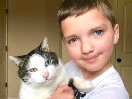 Boy with different colored eyes adopts cat who shares the same condition