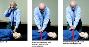 Image result for Chest Compressions
