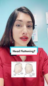 Palpation can help differentiate between something like craniosynostosis or  positional plagiocephaly. Premature fusion or craniosynostosis may also  have palpable ridges but sometimes its def not ...