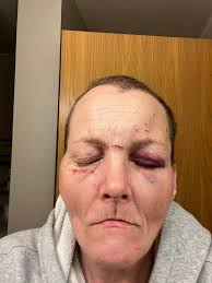 Asbestos exposure in TDCJ unit, what can be done?