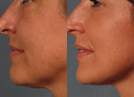 Health and Beauty Blog Based in Miami