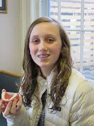 What happens when you eat and chew with braces? All About Bite Blocks