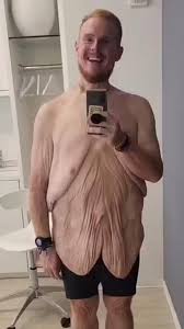 Obese reality star Casey King loses 600 pounds in life ...