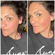 The color against that skin is everything 😍