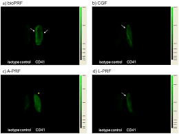 Acs petroleum research fund (acs prf) grants are intended as seed money, to enable an investigator to initiate a new since the first acs prf grants were approved in 1953, several grant. Ijms Free Full Text Quantitative Near Infrared Imaging Of Platelets In Platelet Rich Fibrin Prf Matrices Comparative Analysis Of Bio Prf Leukocyte Rich Prf Advanced Prf And Concentrated Growth Factors