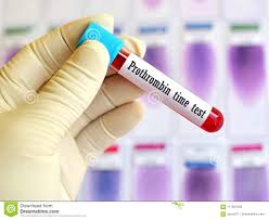 Prothrombin Time Test Stock Image Image Of Prothrombin 111657939