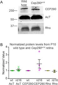 A lathe (/ l eɪ ð /) is a machine tool that rotates a workpiece about an axis of rotation to perform various operations such as cutting, sanding, knurling, drilling, deformation, facing, and turning, with tools that are applied to the workpiece to create an object with symmetry about that axis. Superresolution Microscopy Reveals Photoreceptor Specific Subciliary Location And Function Of Cep290 Biorxiv