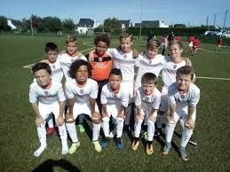 Club foot is usually diagnosed after a baby is born, although it may be spotted during the routine ultrasound scan done between 18 and 21 weeks. Le Centre De Formation Fc Lorient