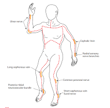 Escharotomy is usually done within the first 2 to 6 hours of a burn injury. Nsw Aci On Twitter Download The New Escharotomy For Burn Patients Clinical Guidelines From The Nswaci Statewide Burn Injury Service Https T Co Sbxrtatsyc Nswaci Https T Co Ejqlyt04zn