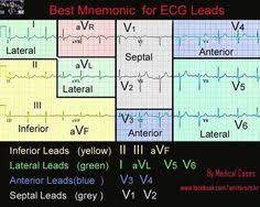 243 Best Ecg Images In 2019 Cardiac Nursing Nursing Notes