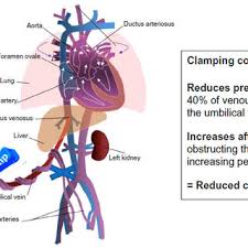 Image result for Delayed Transition from Fetal Circulation
