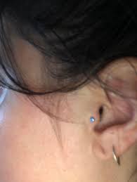 Is This A Bad Tragus Piercing I Just Got It Changed At A Shop Other Than The One I Got It Pierced At In Feb The Woman Who Changed It Said They