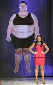Pin On My Time On Extreme Weight Loss