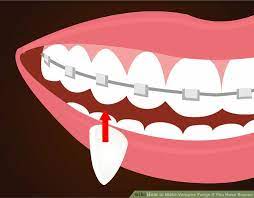 How To Make Vampire Fangs If You Have Braces 12 Steps Vampire Fangs Vampire Costume Diy Halloween Fangs
