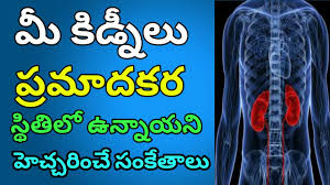 Kidney Infection Symptoms In Telugu Signs And Symptoms Of Kidney Infection Telugu Youtube