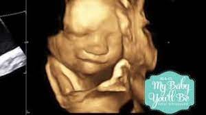 4d To 5d Ultrasound My Baby You Ll Be 3d Boise Youtube