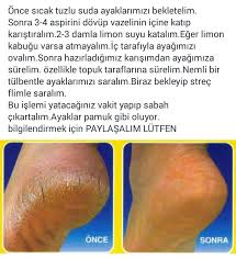 Nese Nin Gozdeleri Saglikli Spor Aktiviteleri Dogal