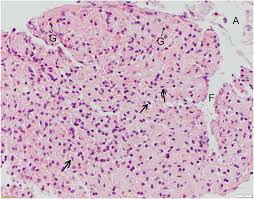 Histological Evaluation Of Five Suture Materials In The