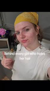 Hilary Golston Embarrassing Hair