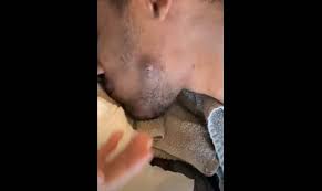 This is best done before shaving and before going to sleep at night. Popping Ingrown Hair Cyst With Black Pus At Home New Pimple Popping Videos