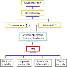 Full Text Biomarkers In Acute Myocardial Infarction