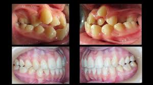 Enquire for a fast quote ★ free consultation ★ choose from 6 dentists in taman connaught with 2 verified patient reviews. Lau Dental Taman Connaught Facebook